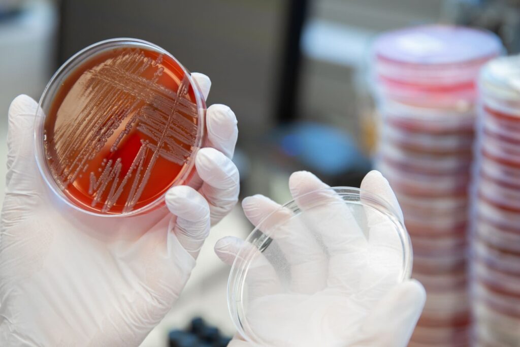 Agar Petrischale mit Keimen besiedelt