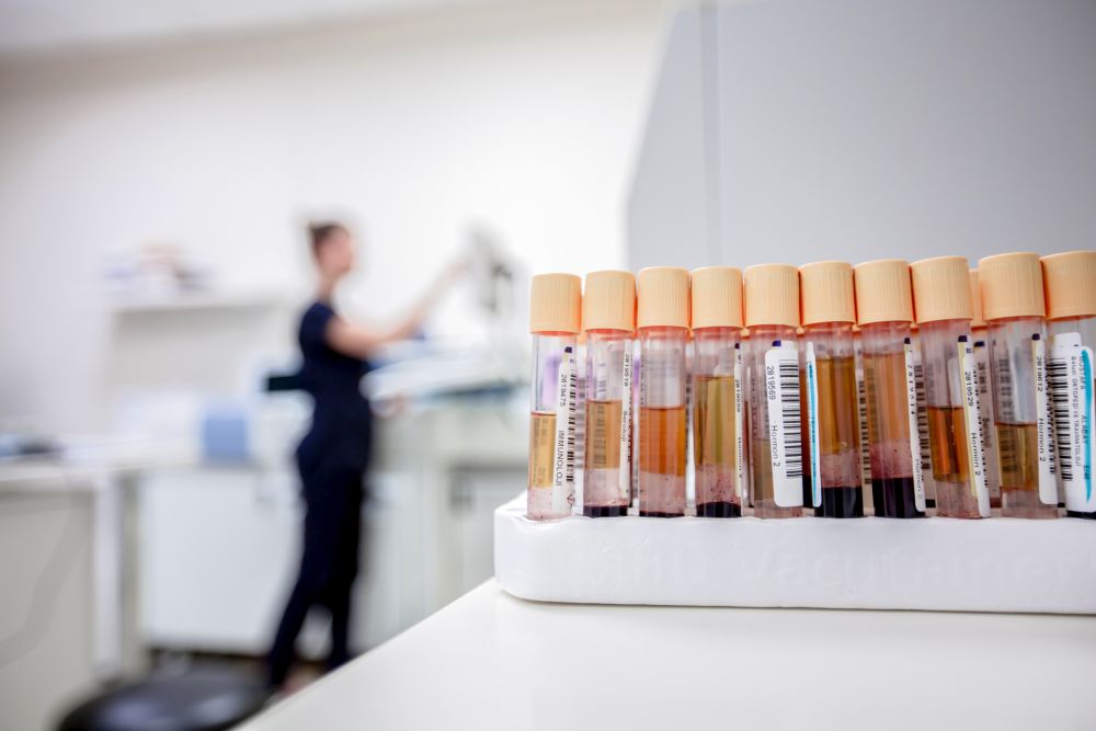 EMA lehnt Zulassung von Alzheimer-Medikament Lecanemab ab